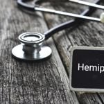 Congenital and Acquired Hemiparesis