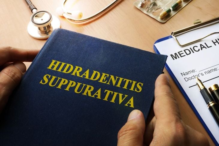 Recognizing and Treating Hidradenitis Suppurativa
