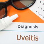Uveitis is a Serious Eye Disease Masquerading as Minor