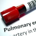 Understanding Pulmonary Embolism: Symptoms, Causes, and Prevention