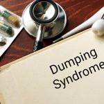 10 Tips for Avoiding Dumping Syndrome Symptoms