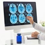 Cancers of the Central Nervous System