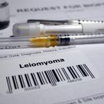 Leiomyoma: Smooth Muscle Tumors
