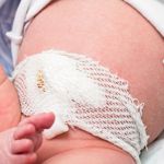 Belly Button Infections In Infants