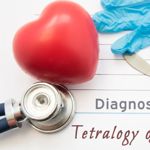 What is Tetralogy of Fallot?