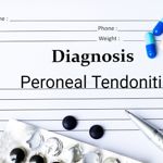 Foot Pain From Peroneal Tendonitis