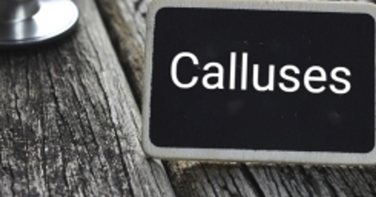 How Calluses Form and How to Treat Them Facty Health