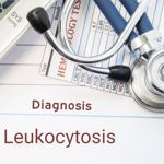 High White Blood Cell Counts and Leukocytosis