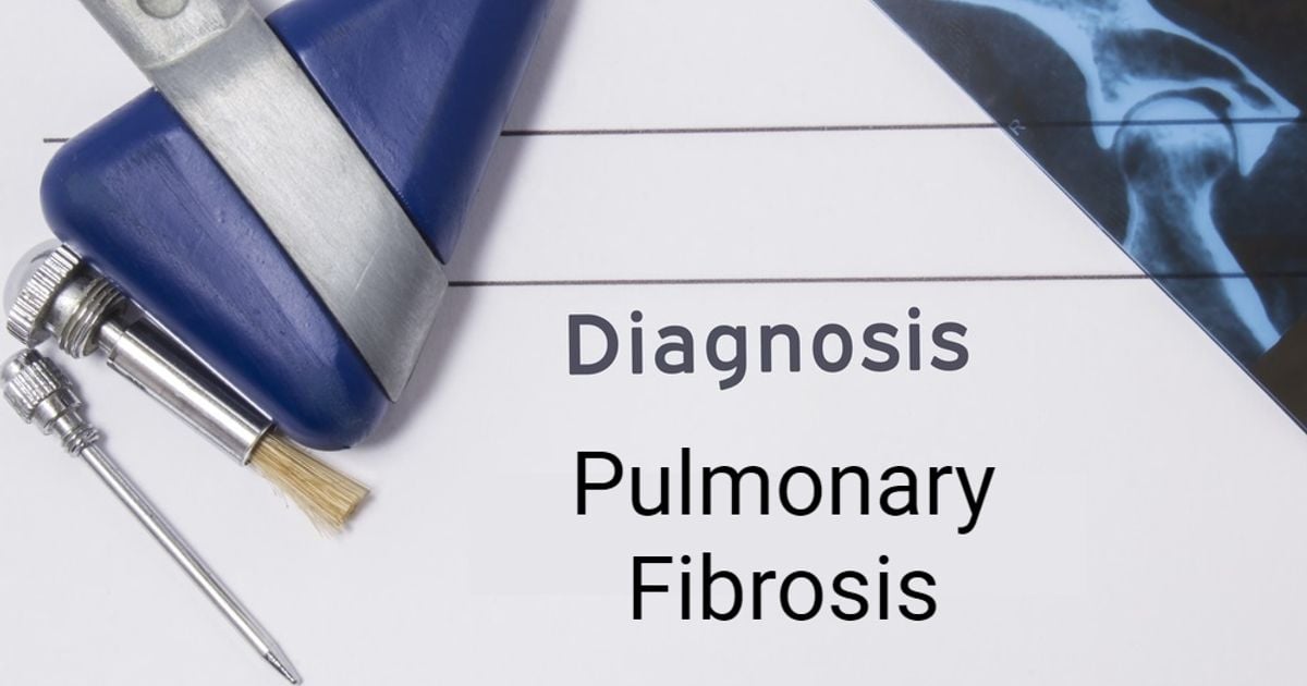 Pulmonary Fibrosis and Lung Scarring Explained Facty Health