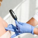Skin Lesions and Their Diagnosis
