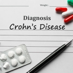 Crohn's Disease Development and Flares
