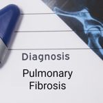 Pulmonary Fibrosis and Lung Scarring Explained