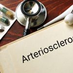 Diet and Arteriosclerosis: How Your Food Choices Affect Your Arteries