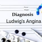 Understanding, Treating, and Preventing Ludwig's Angina