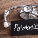 How Serious is Periodontitis?