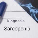 Sarcopenia: Preventing and Treating Age-Related Muscle Loss