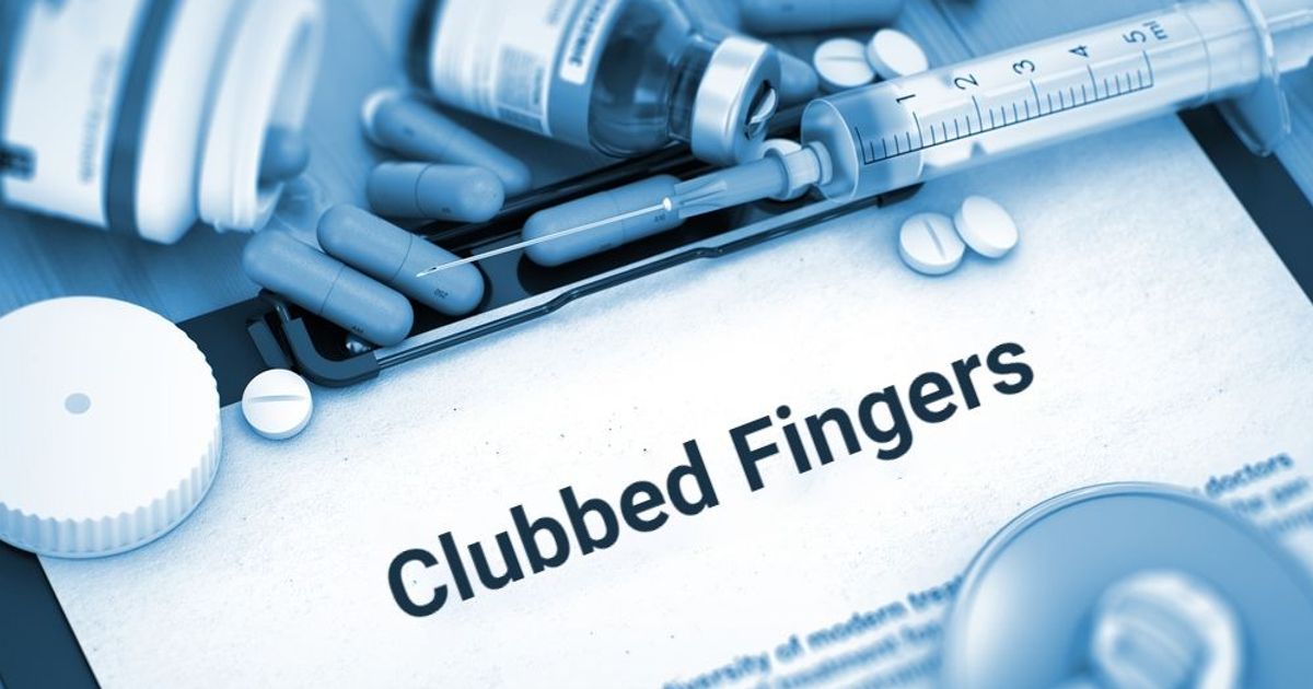 Clubbed Fingers as an Early Sign of Illness Facty Health