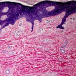 How the Dermis Impacts Overall Health
