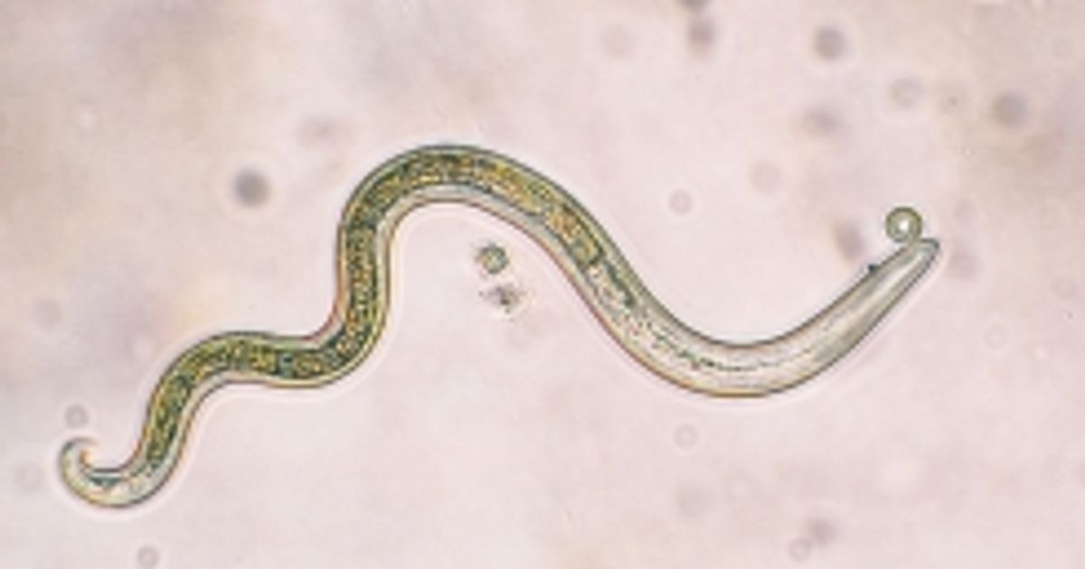 The Most Common Parasites that Can Affect Humans Facty Health