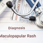 What Causes a Maculopapular Rash?