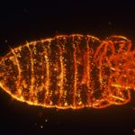 Dealing with Body Lice: Symptoms and Solutions