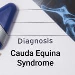 What is Cauda Equina Syndrome?
