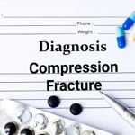Compression Fracture Causes, Symptoms, and Treatments