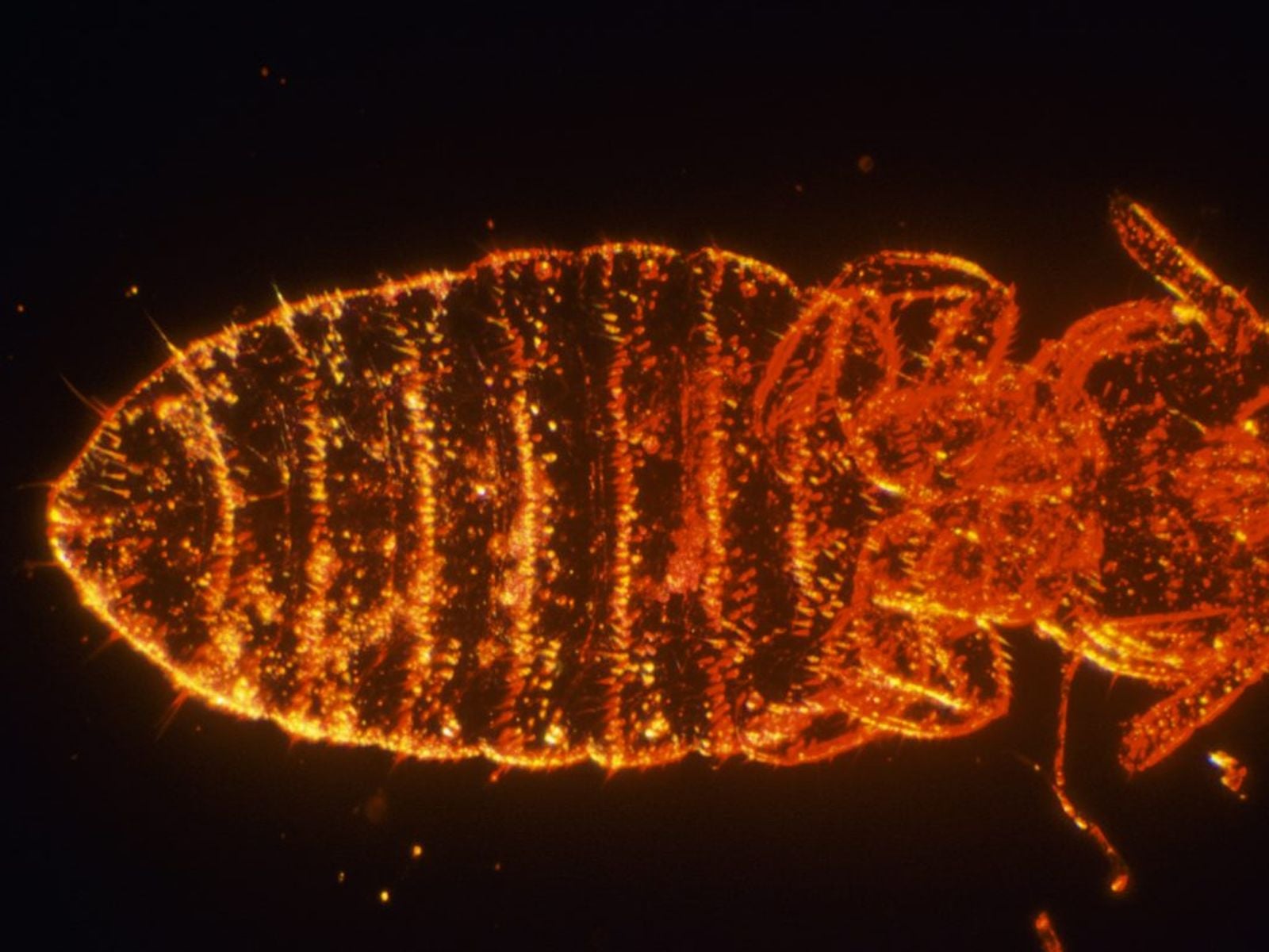 Body Lice Eggs