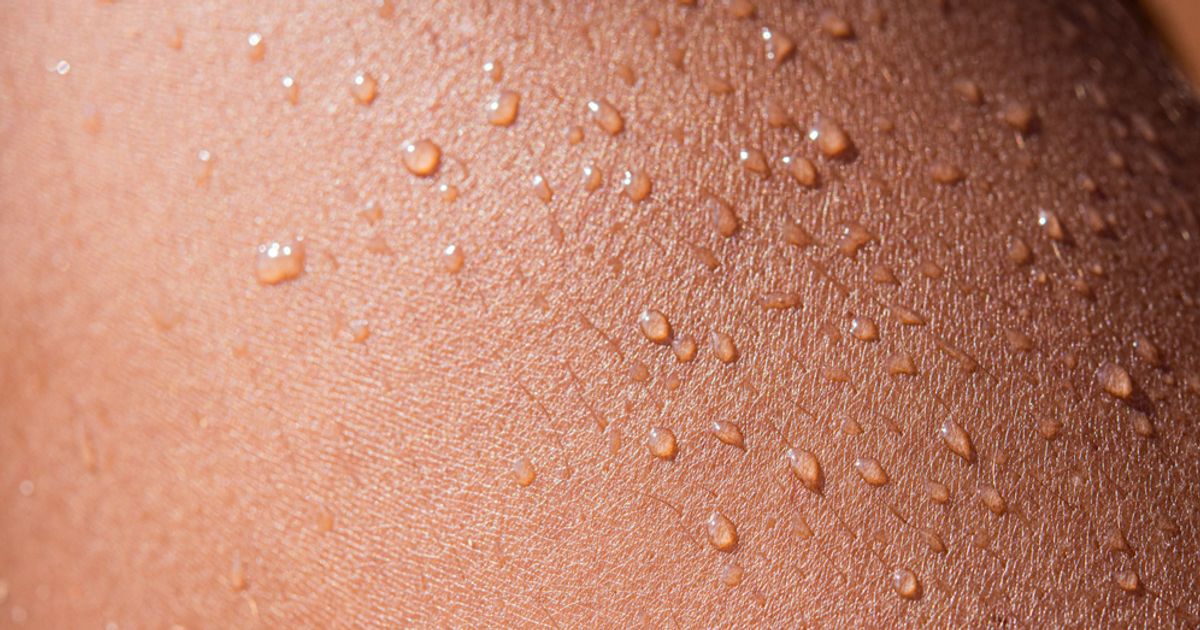 Maceration — the Effects of LongTerm Fluid Exposure Facty Health