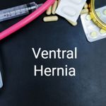Causes, Symptoms, and Treatment of Ventral Hernias