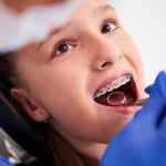 Signs Your Child May Need Braces