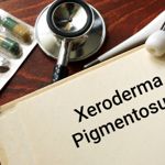 Xeroderma Pigmentosum, a Rare Genetic Condition