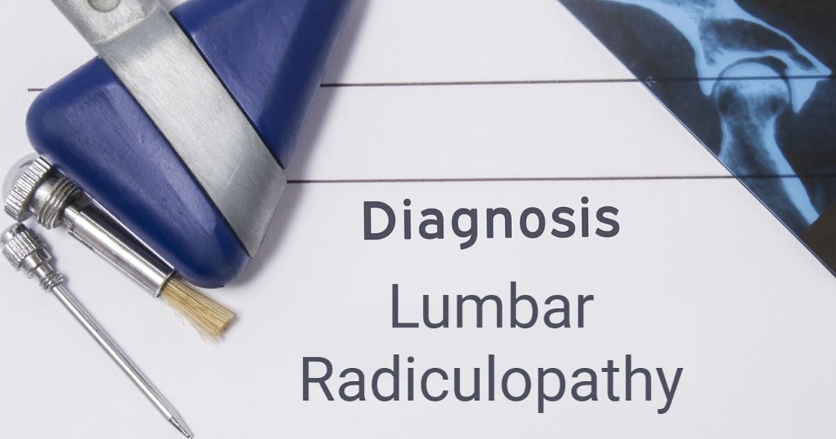 Lumbar Radiculopathy How to Manage and Reduce Pain Facty Health