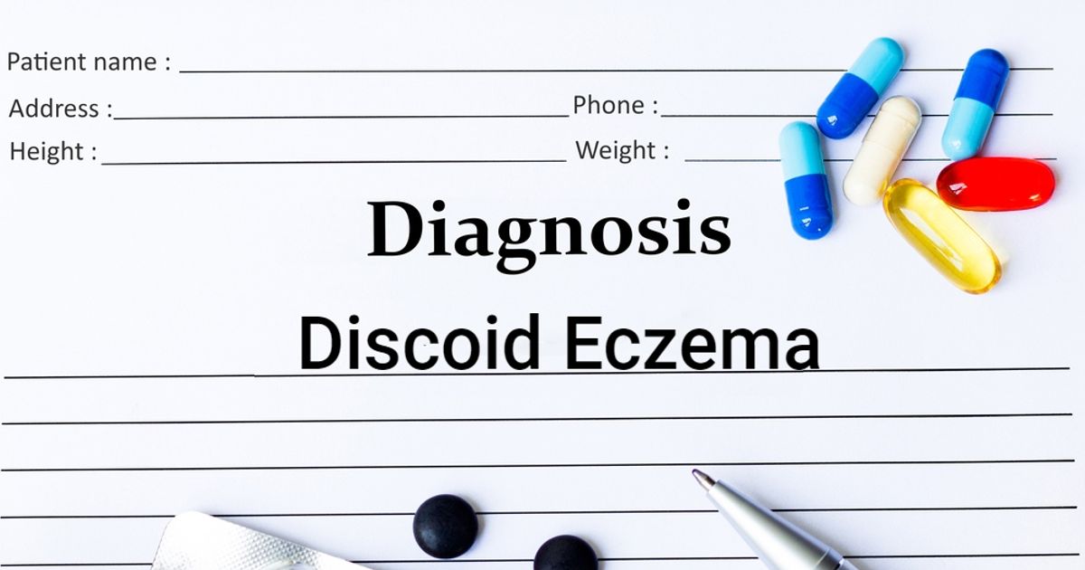 Causes, Symptoms, and Treatments of Discoid Eczema Facty Health