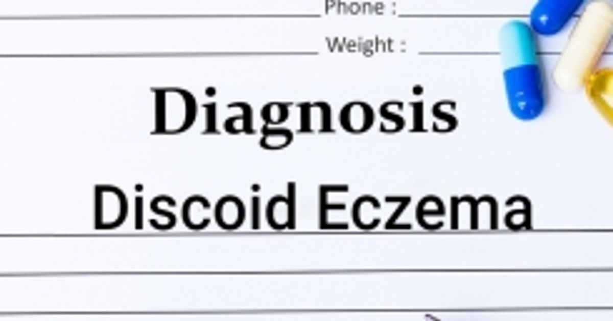 Causes, Symptoms, and Treatments of Discoid Eczema Facty Health