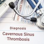 Rare and Dangerous Cavernous Sinus Thrombosis