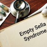 Empty Sella Syndrome and Pituitary Function