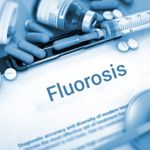 Triggers, Symptoms, and Prevention of Fluorosis