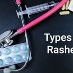 The Most Common Rashes That Affect the Skin