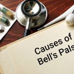 What Causes Bell's Palsy?