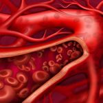 How Hemoglobin Levels Affect Your Health
