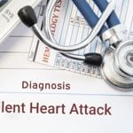 What Is a Silent Heart Attack?