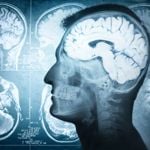 25 Amazing Facts About Your Brain