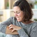 Most Common Causes of Itching