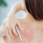 How To Prevent Or Reduce Eczema Outbreaks