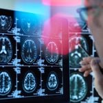 Could These 10 Symptoms Mean You Have Nerve Damage?