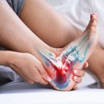 Achilles Tendinitis: Everything You Need to Know