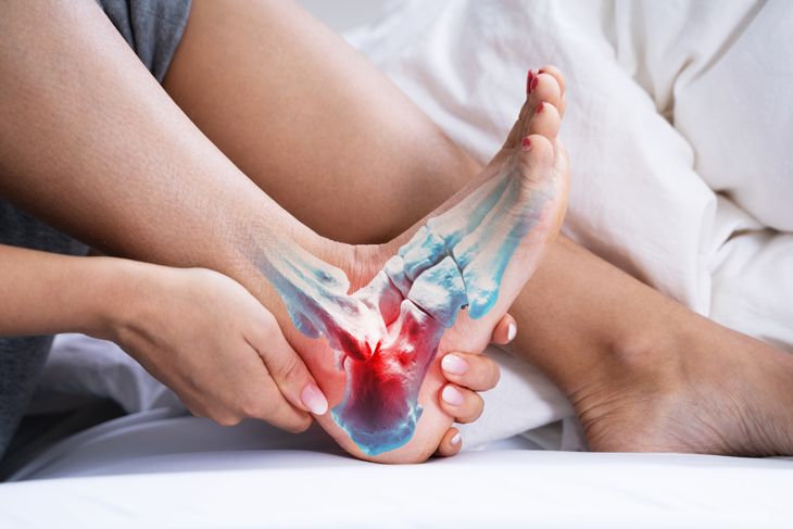 Achilles Tendinitis: Everything You Need to Know