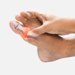 The Ultimate Guide to Gout