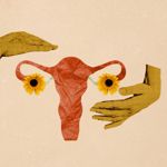 How to Recognize and React to an Ovarian Torsion